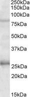 GPRIN Family Member 3 antibody, PA5-19346, Invitrogen Antibodies, Western Blot image 