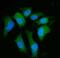 Protein Phosphatase 2 Scaffold Subunit Aalpha antibody, A02822-2, Boster Biological Technology, Immunofluorescence image 
