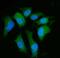 Serine/threonine-protein phosphatase 2A 65 kDa regulatory subunit A alpha isoform antibody, A02822-2, Boster Biological Technology, Immunofluorescence image 