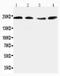 Reticulon 4 Receptor antibody, PA5-79942, Invitrogen Antibodies, Western Blot image 