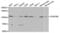 Platelet Derived Growth Factor Receptor Beta antibody, abx001792, Abbexa, Western Blot image 