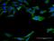 Calmodulin antibody, H00000808-M11, Novus Biologicals, Immunocytochemistry image 