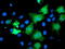 Katanin Regulatory Subunit B1 antibody, TA503781, Origene, Immunofluorescence image 