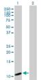 Cytochrome C Oxidase Subunit 7A2 Like antibody, H00009167-B02P, Novus Biologicals, Western Blot image 