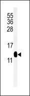 C-X9-C Motif Containing 2 antibody, MBS9210192, MyBioSource, Western Blot image 