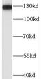 BUB1 Mitotic Checkpoint Serine/Threonine Kinase B antibody, FNab00989, FineTest, Western Blot image 
