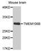 Transmembrane Protein 106B antibody, MBS129856, MyBioSource, Western Blot image 