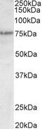 TATA-Box Binding Protein antibody, 42-997, ProSci, Western Blot image 