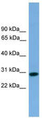 Regulator Of Calcineurin 2 antibody, TA340079, Origene, Western Blot image 