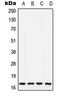 Cytochrome C Oxidase Subunit 5A antibody, LS-C353163, Lifespan Biosciences, Western Blot image 