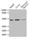 Glutamic-Oxaloacetic Transaminase 1 antibody, LS-B12294, Lifespan Biosciences, Western Blot image 