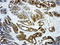 Galectin 3 antibody, LS-C796932, Lifespan Biosciences, Immunohistochemistry paraffin image 