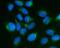 Stathmin-2 antibody, A04729-2, Boster Biological Technology, Immunofluorescence image 