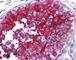 Basigin (Ok Blood Group) antibody, 49-195, ProSci, Immunohistochemistry paraffin image 