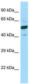 GTP-specific succinyl-CoA synthetase subunit beta antibody, TA333987, Origene, Western Blot image 