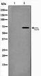 Heat Shock Transcription Factor 1 antibody, orb106472, Biorbyt, Western Blot image 