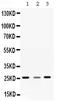 Sorcin antibody, RP1110, Boster Biological Technology, Western Blot image 