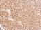 Exosome Component 3 antibody, GTX116123, GeneTex, Immunohistochemistry paraffin image 