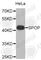 Speckle Type BTB/POZ Protein antibody, A7621, ABclonal Technology, Western Blot image 