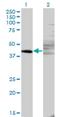 Zinc Finger And SCAN Domain Containing 9 antibody, H00007746-M06, Novus Biologicals, Western Blot image 