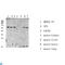 Receptor Interacting Serine/Threonine Kinase 2 antibody, LS-C813585, Lifespan Biosciences, Western Blot image 