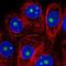 Zinc Finger Matrin-Type 5 antibody, NBP2-56203, Novus Biologicals, Immunocytochemistry image 