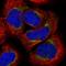 Armadillo Repeat Containing 1 antibody, HPA026085, Atlas Antibodies, Immunocytochemistry image 