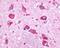G Protein-Coupled Rec. v40 antibody, PA1-32744, Invitrogen Antibodies, Immunohistochemistry paraffin image 