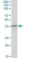 BAG family molecular chaperone regulator 1 antibody, H00000573-M02, Novus Biologicals, Western Blot image 