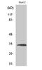 Ribosomal Protein S3 antibody, A01542-1, Boster Biological Technology, Western Blot image 