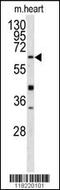 Gamma-Glutamyltransferase 5 antibody, 62-877, ProSci, Western Blot image 