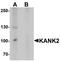 KN motif and ankyrin repeat domain-containing protein 2 antibody, TA319878, Origene, Western Blot image 