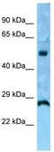 Interleukin 13 Receptor Subunit Alpha 1 antibody, TA343310, Origene, Western Blot image 