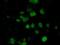 EMG1 N1-Specific Pseudouridine Methyltransferase antibody, NBP2-02575, Novus Biologicals, Immunocytochemistry image 