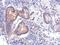 Branched Chain Keto Acid Dehydrogenase Kinase antibody, PA5-31455, Invitrogen Antibodies, Immunohistochemistry paraffin image 