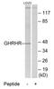 Growth hormone-releasing hormone receptor antibody, MBS003751, MyBioSource, Western Blot image 