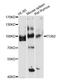 Integrin Subunit Beta 2 antibody, MBS127028, MyBioSource, Western Blot image 