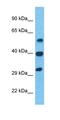 Leukocyte elastase inhibitor antibody, orb327271, Biorbyt, Western Blot image 