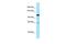 Structural Maintenance Of Chromosomes 6 antibody, PA5-45522, Invitrogen Antibodies, Western Blot image 