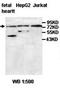 ATP Binding Cassette Subfamily B Member 8 antibody, orb77717, Biorbyt, Western Blot image 