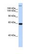 Trinucleotide Repeat Containing Adaptor 6A antibody, orb324915, Biorbyt, Western Blot image 