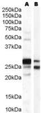 Catechol-O-Methyltransferase antibody, LS-B4880, Lifespan Biosciences, Western Blot image 