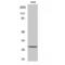 Troponin I3, Cardiac Type antibody, LS-C386549, Lifespan Biosciences, Western Blot image 