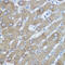 Histone Deacetylase 6 antibody, GTX02885, GeneTex, Immunohistochemistry paraffin image 