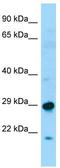 Sperm Associated Antigen 7 antibody, TA333958, Origene, Western Blot image 