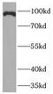 High affinity cAMP-specific and IBMX-insensitive 3 ,5 -cyclic phosphodiesterase 8A antibody, FNab06262, FineTest, Western Blot image 