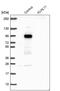 Kelch Like Family Member 11 antibody, PA5-54668, Invitrogen Antibodies, Western Blot image 