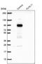 Kelch Like Family Member 11 antibody, PA5-54668, Invitrogen Antibodies, Western Blot image 