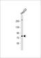 Polymeric Immunoglobulin Receptor antibody, 63-514, ProSci, Western Blot image 