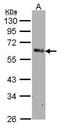 Prostaglandin-Endoperoxide Synthase 1 antibody, GTX104634, GeneTex, Western Blot image 